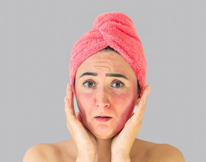 Skin Rashes and Swelling After Eating Certain Foods: Causes, Symptoms, and When to Seek Help